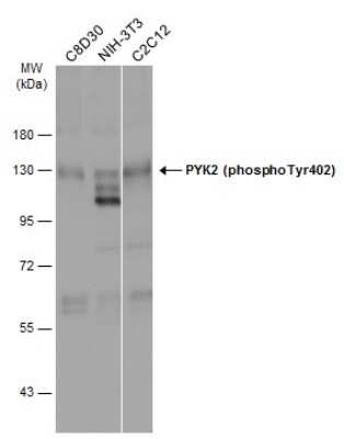 Western Blot: PYK2/FAK2 [p Tyr402] Antibody [NBP3-13314]